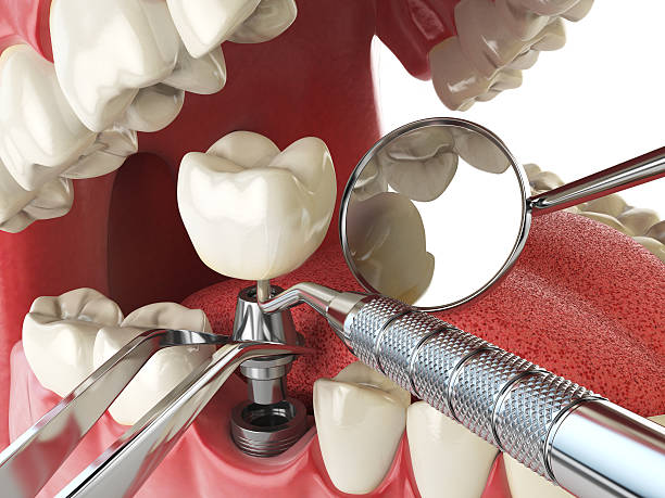 Best Emergency Dental Surgery in Villa Ridge, MO