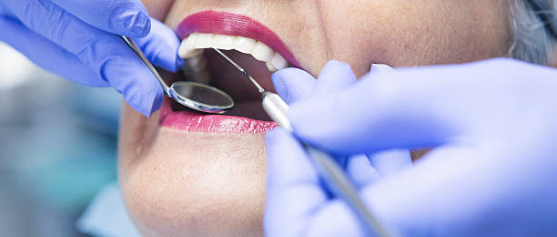 Best Emergency Treatment for Toothache in Villa Ridge, MO